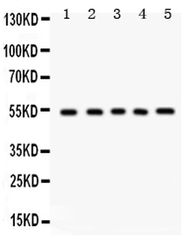 Vitronectin/VTN Rabbit Polyclonal Antibody