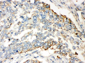 Wnt2b Rabbit Polyclonal Antibody