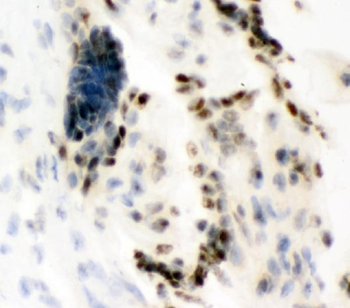 Ku80/XRCC5 Antibody