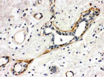 Yes1 Rabbit Polyclonal Antibody