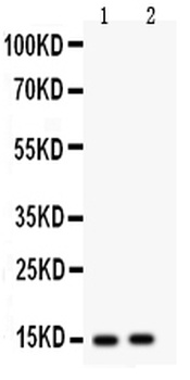 Fatty Acid Binding Protein 5/FABP5 Rabbit Polyclonal Antibody