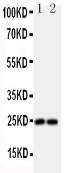 Fibroblast growth factor 19 FGF19 Rabbit Polyclonal Antibody