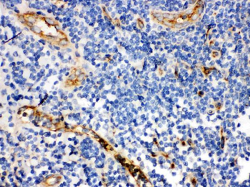 CD59 glycoprotein CD59 Rabbit Polyclonal Antibody