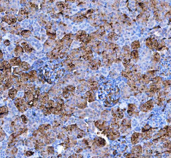 Aquaporin 1/AQP1 Antibody