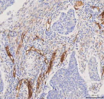 Aquaporin 1/AQP1 Antibody