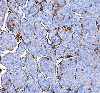Aquaporin 1/AQP1 Antibody