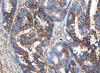 Aquaporin 1/AQP1 Antibody