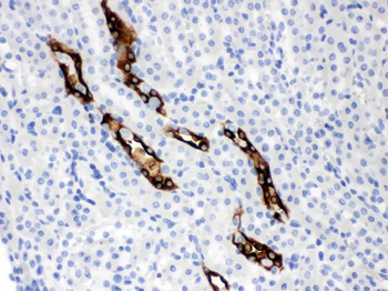 Aquaporin 2/AQP2 Rabbit Polyclonal Antibody