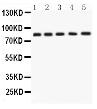 APLP1 Rabbit Polyclonal Antibody