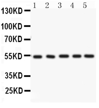ARSA Rabbit Polyclonal Antibody