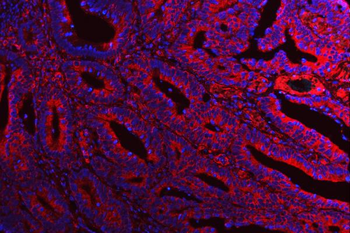 ATG14L Antibody