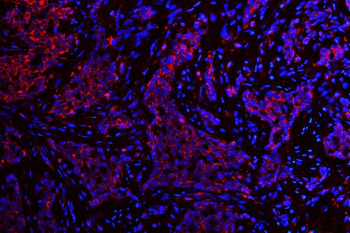 ATG14L Antibody