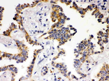 ATG14L Antibody