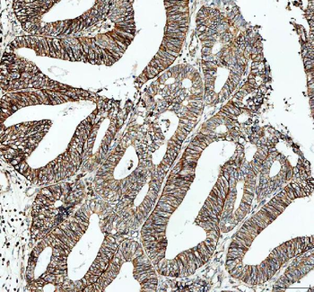 alpha 1 Sodium Potassium ATPase/ATP1A1 Antibody