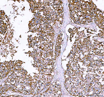 alpha 1 Sodium Potassium ATPase/ATP1A1 Antibody