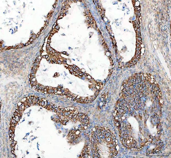 alpha 1 Sodium Potassium ATPase/ATP1A1 Antibody