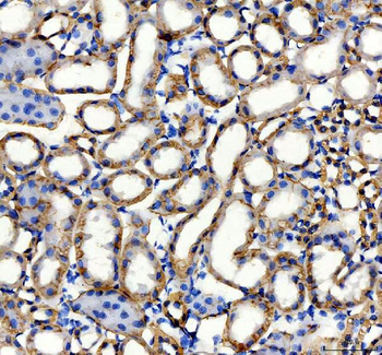 alpha 1 Sodium Potassium ATPase/ATP1A1 Antibody