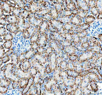 alpha 1 Sodium Potassium ATPase/ATP1A1 Antibody