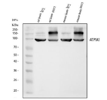 alpha 1 Sodium Potassium ATPase/ATP1A1 Antibody