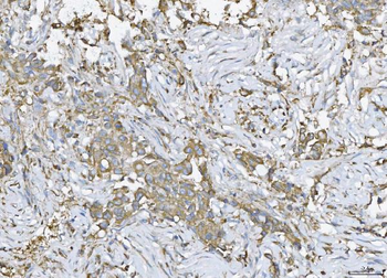 ATX2/ATXN2 Rabbit Polyclonal Antibody