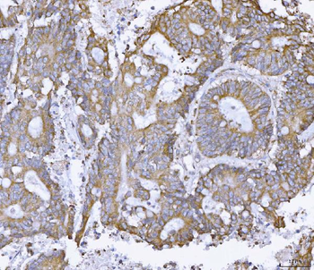 ATX2/ATXN2 Rabbit Polyclonal Antibody