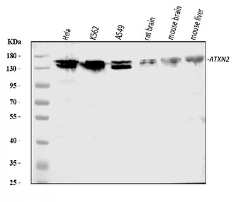 ATX2/ATXN2 Rabbit Polyclonal Antibody