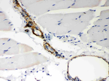 BAK/BAK1 Antibody