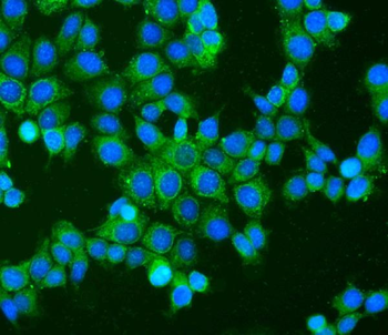 BAK/BAK1 Antibody