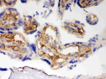 BAK/BAK1 Antibody