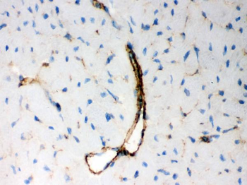 BAK/BAK1 Antibody