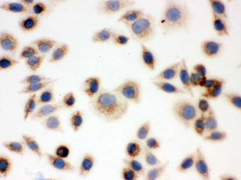 BAK/BAK1 Antibody
