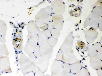 BAK/BAK1 Antibody