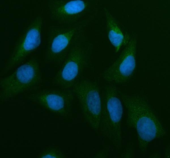 Cdc25B Rabbit Polyclonal Antibody
