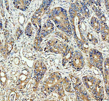 Cdc25B Rabbit Polyclonal Antibody