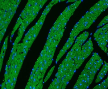 CPT1B Rabbit Polyclonal Antibody