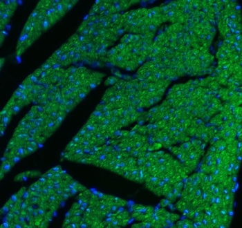 CPT1B Rabbit Polyclonal Antibody