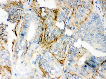 PKLR Rabbit Polyclonal Antibody