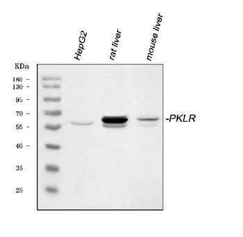 PKLR Rabbit Polyclonal Antibody