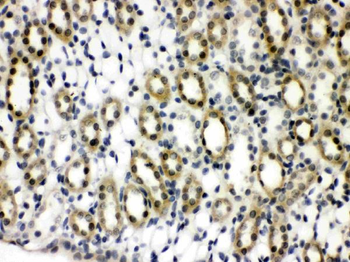 TCPTP/PTPN2 Rabbit Polyclonal Antibody