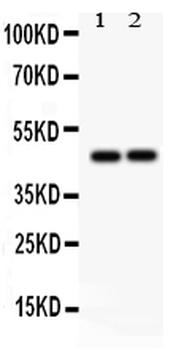 TCPTP/PTPN2 Rabbit Polyclonal Antibody