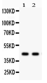 alpha Sarcoglycan/SGCA Rabbit Polyclonal Antibody