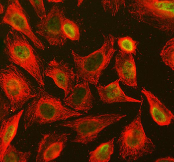 STAT3 Rabbit Polyclonal Antibody