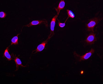 STAT5b Rabbit Polyclonal Antibody