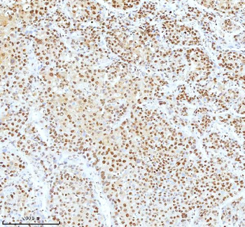 Ku70/XRCC6 Antibody