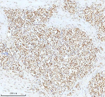 Ku70/XRCC6 Antibody