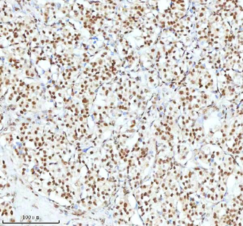 Ku70/XRCC6 Antibody