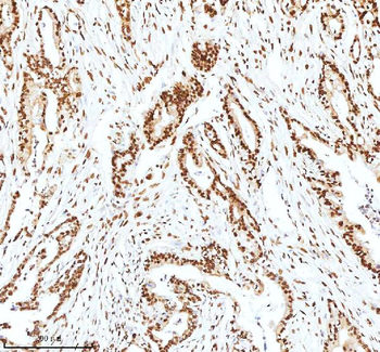 Ku70/XRCC6 Antibody