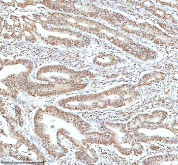 Ku70/XRCC6 Antibody