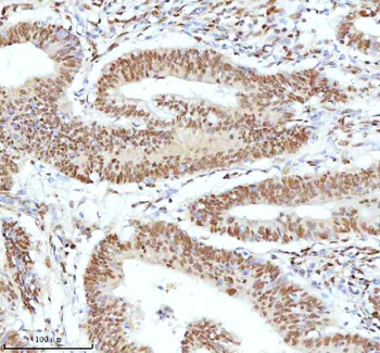 Ku70/XRCC6 Antibody
