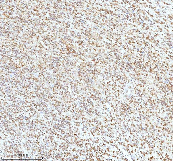 Ku70/XRCC6 Antibody